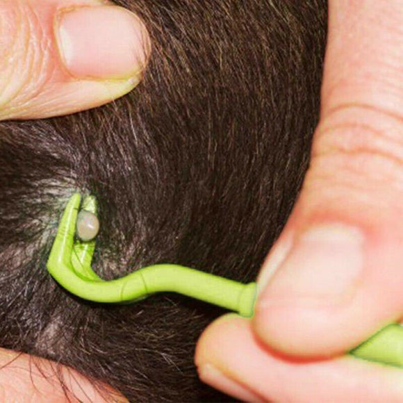 Mitey Tick Free Tick Remover Kit - RnR Galore